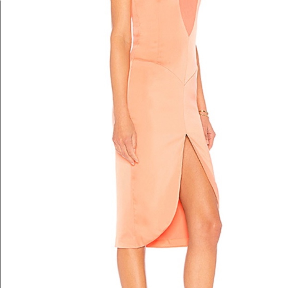 NBD dress
